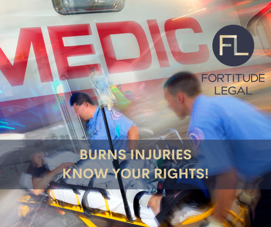 BURNS INJURIES - KNOW YOUR RIGHTS!
